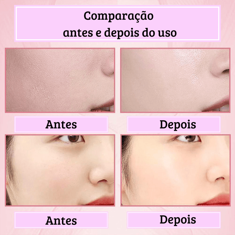 Creme para pele - Hunmui™ [Removedor de Melasma, Clareador]